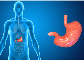 Acidity, Gas, and Bloating: Why They Happen and How to Prevent Them