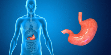 Acidity, Gas, and Bloating: Why They Happen and How to Prevent Them