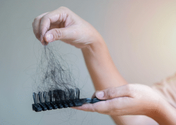 Why Everyone Is Suddenly Talking About Hair Loss – and the Surprising Products Nobody Wants to Admit They’re Using